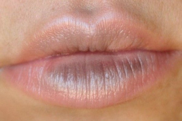 Dark Lip Dark Lip