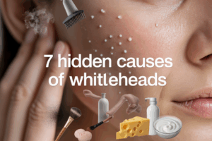 7 Hidden Causes of Whiteheads Nobody Talks About